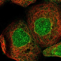 ZBTB41 Antibody, Novus Biologicals 25 &mu;L; Unlabeled:Antibodies, Polyclonal